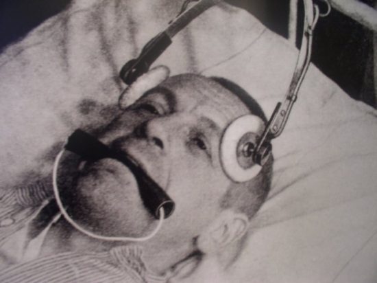 Male patient recieving Electro-convulsive shock therapy.